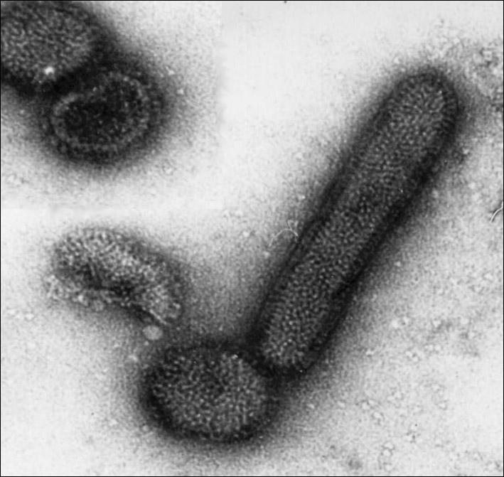 流行性感冒病毒