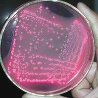 不典型O1群霍乱弧菌