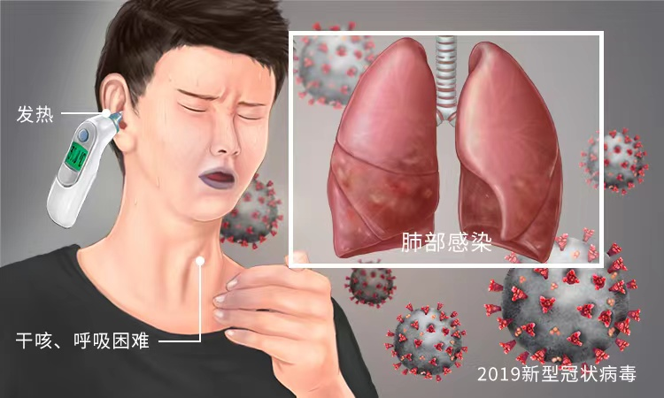 新型冠状病毒感染