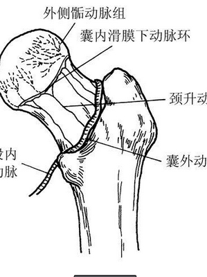 股骨粗隆间骨折