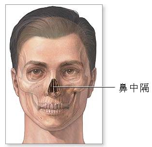 鼻中隔脓肿