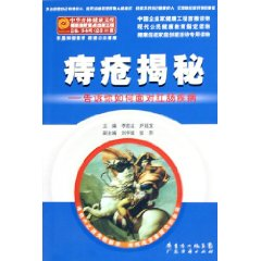 痔疮揭秘