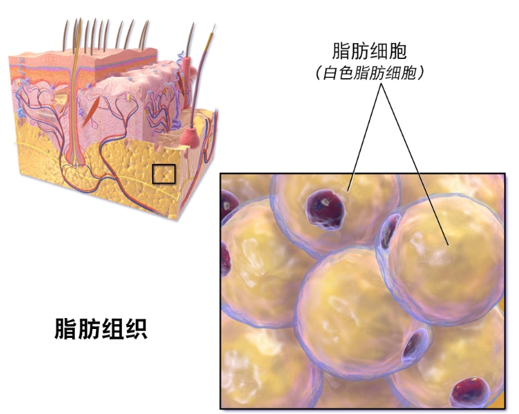 肥胖症