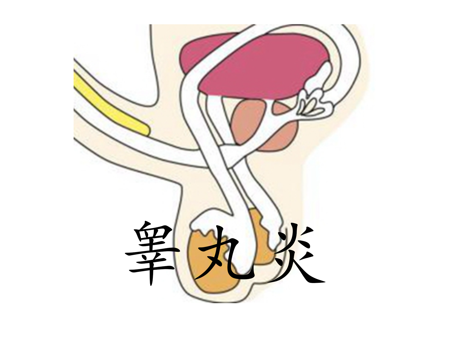 睾丸炎