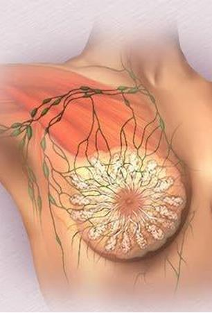 产褥期乳腺炎