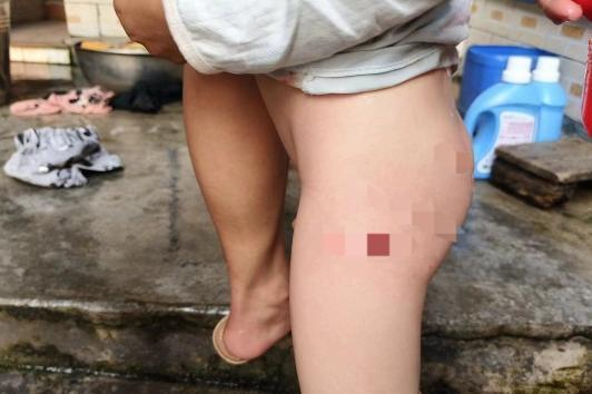 4·6海南野猴进村伤人事件