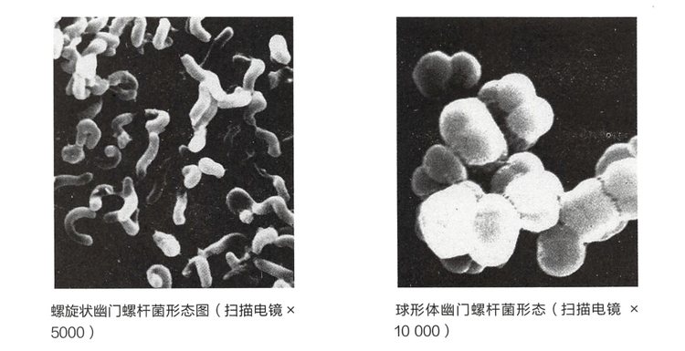 幽门螺杆菌