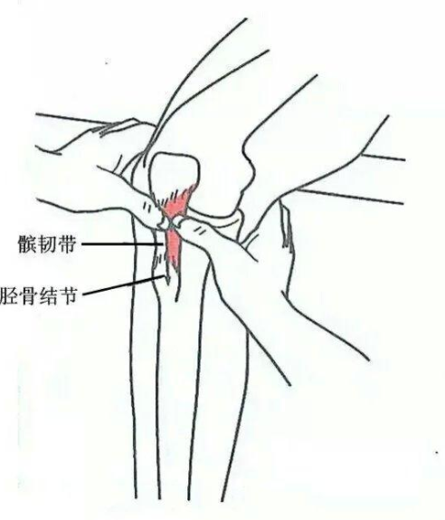 软组织