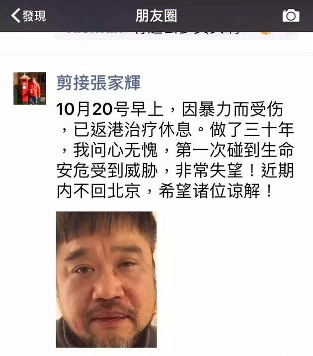 张嘉辉