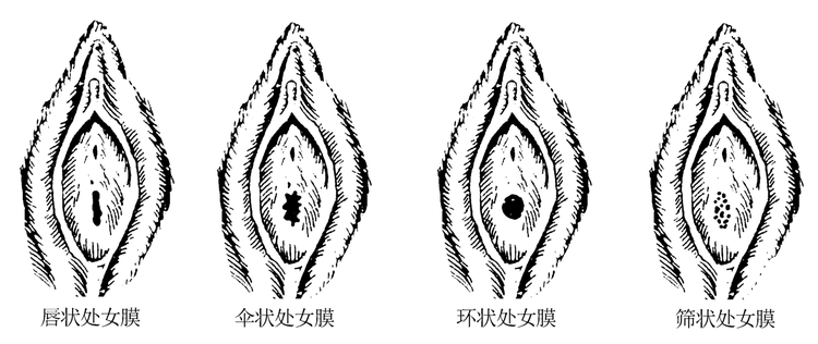 女性外生殖器