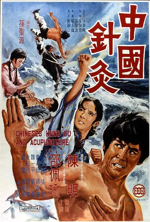 中国针灸