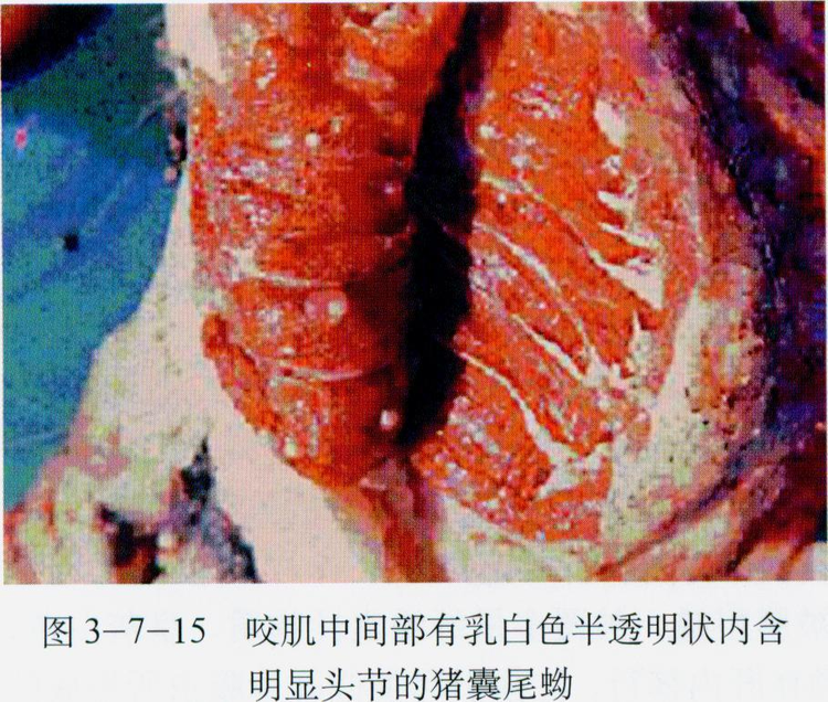 囊尾蚴