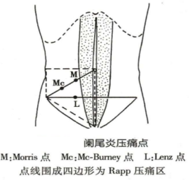 阑尾炎
