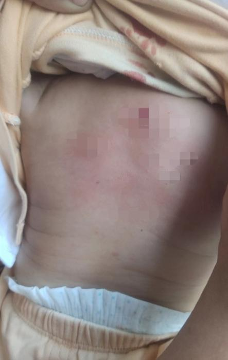 4·6海南野猴进村伤人事件