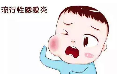 流行性腮腺炎