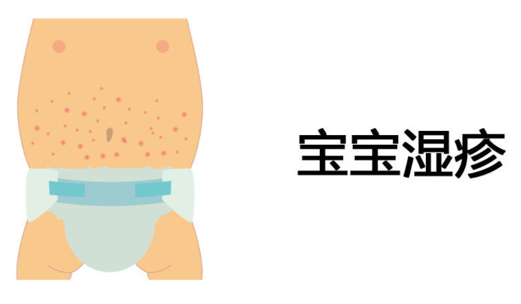 婴儿湿疹