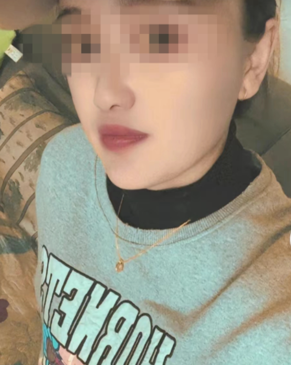 凉山女子疑遭丈夫点火烧伤事件