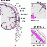 脑卒中