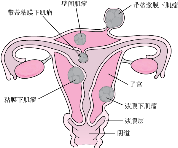 不孕（育）症