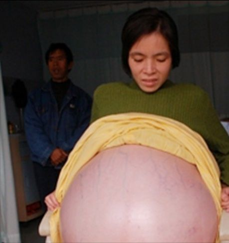 彭细妹