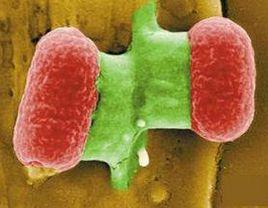 溶血性尿毒综合征