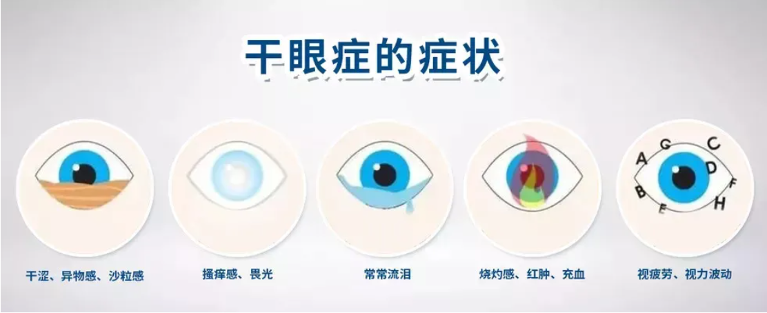 眼干燥症