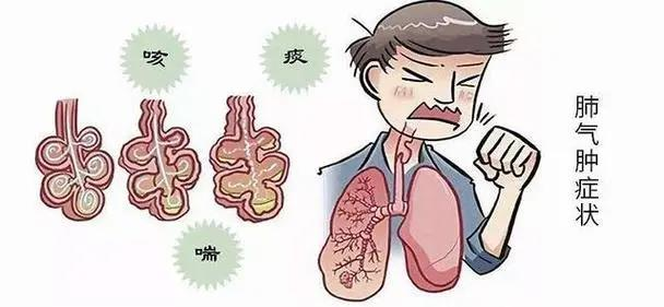 肺气肿