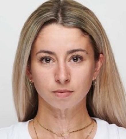 米哈埃拉·佩兹洛娃