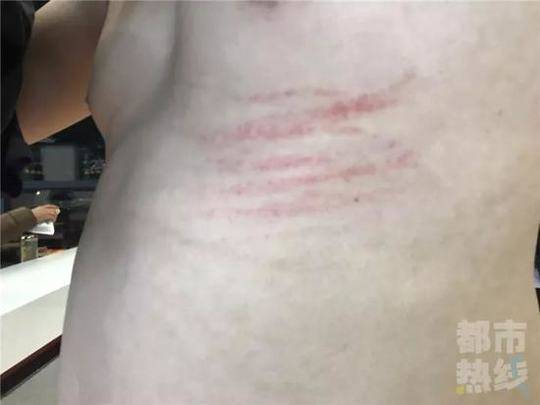 记者调查医院天价停尸费 遭人扒衣殴打关太平间侮辱