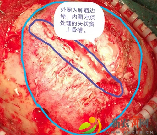 e48cbe718bddb1ea71235e15b23fa7d.jpg