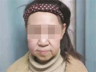 15岁少女长了一张60岁的脸 郭明义爱心团队伸出援手