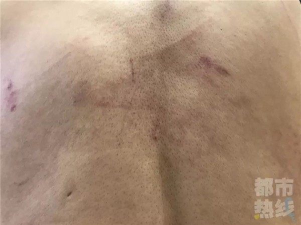 记者调查医院天价停尸费 遭人扒衣殴打关太平间侮辱
