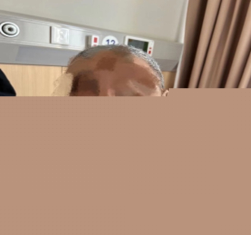 放疗后李先生照射区皮肤无明显色素沉着及破溃.jpg