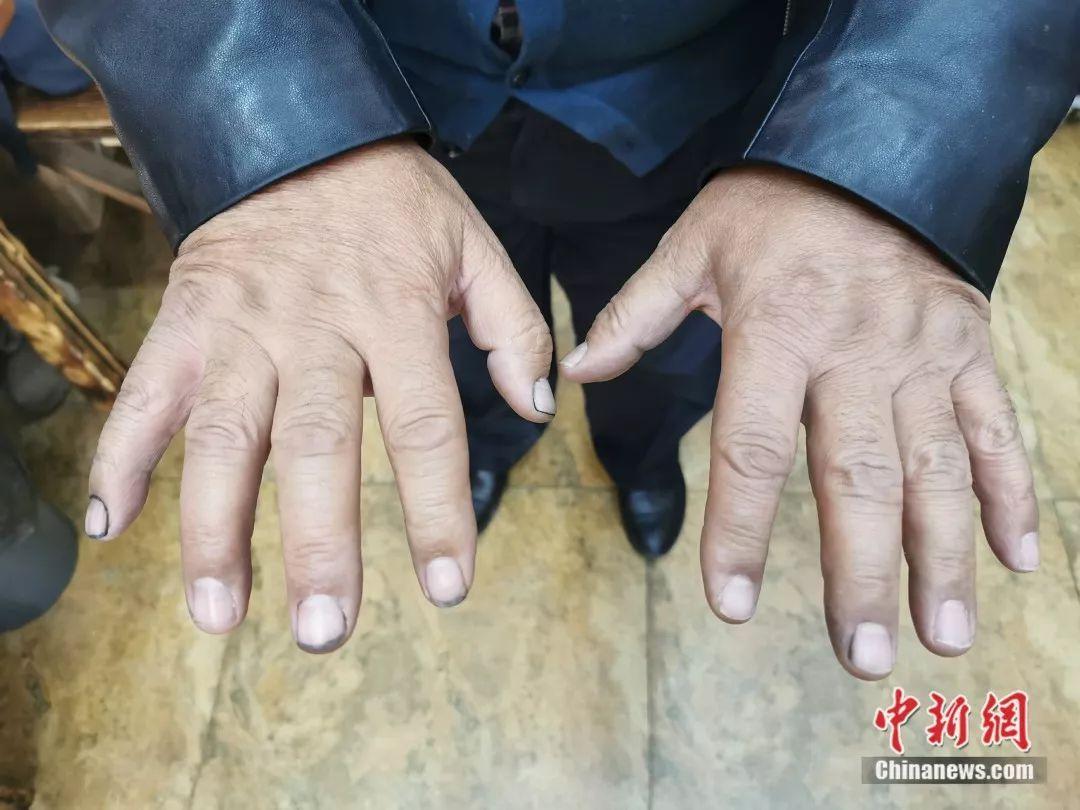 他作画用手不用笔 每一幅作品都有家乡的“泥土味”