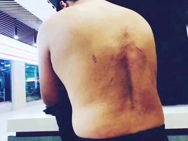 记者调查医院天价停尸费 遭人扒衣殴打关太平间侮辱