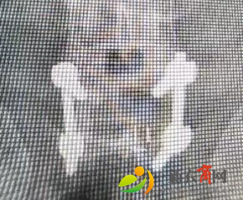 术后X光片.jpg